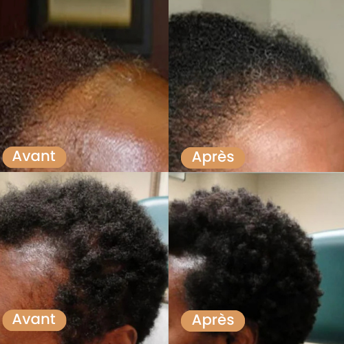 Huile de Batana pour la pousse des cheveux
