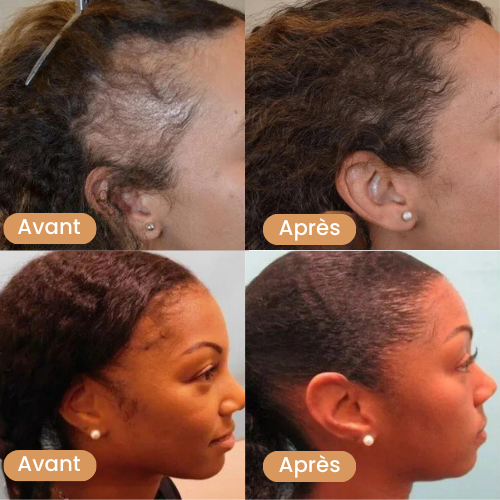 Huile de Batana pour la pousse des cheveux