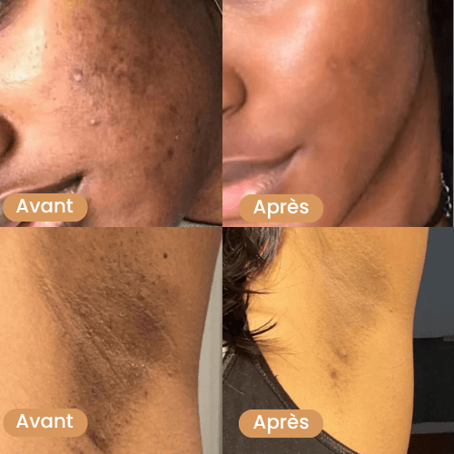 Avant_apres_savon_au_curcuma_1_22aabd1d-e3ee-4c9d-ba09-58f005370afa - Prestiglow™