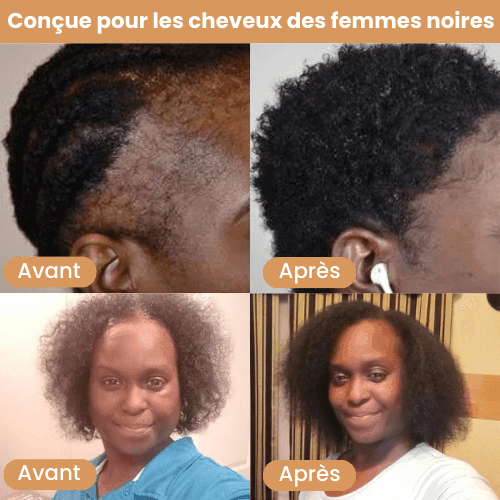 Huile de croissance - Prestiglow™
