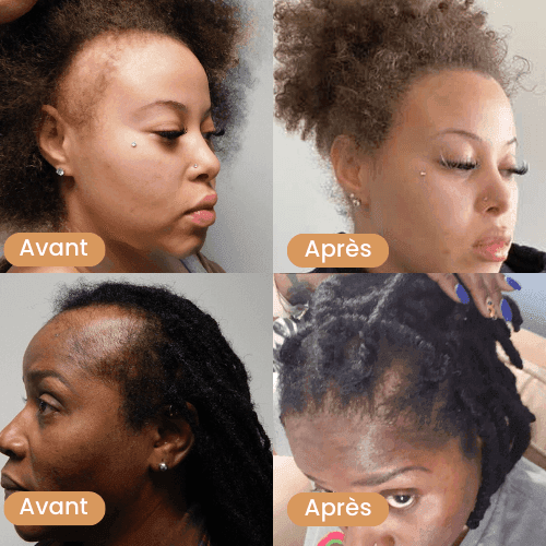 Avant_apres_will_capillaire_prestiglow_5 - Prestiglow™