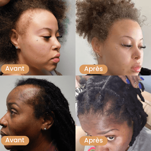 Avant_apres_will_capillaire_prestiglow_5_1851710b-9fab-4231-8cc8-dba809c252cc - Prestiglow™