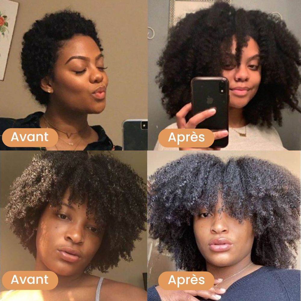Huile de Pousse Intense aux 11 Huiles Naturelles - Prestiglow™