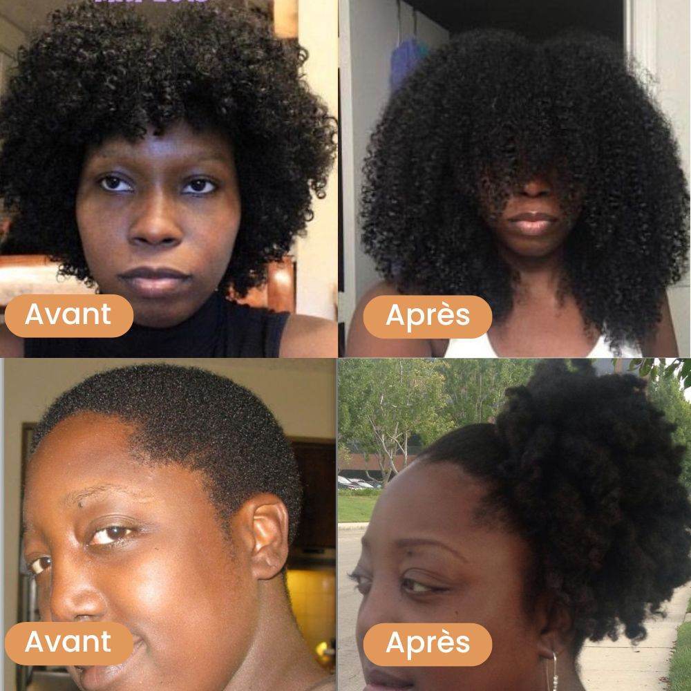 Huile de Pousse Intense aux 11 Huiles Naturelles - Prestiglow™