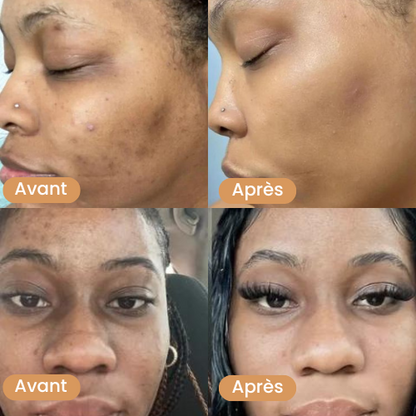 Coton Réducteur d'Imperfections